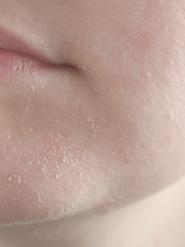 How to Soothe Sensitive Skin